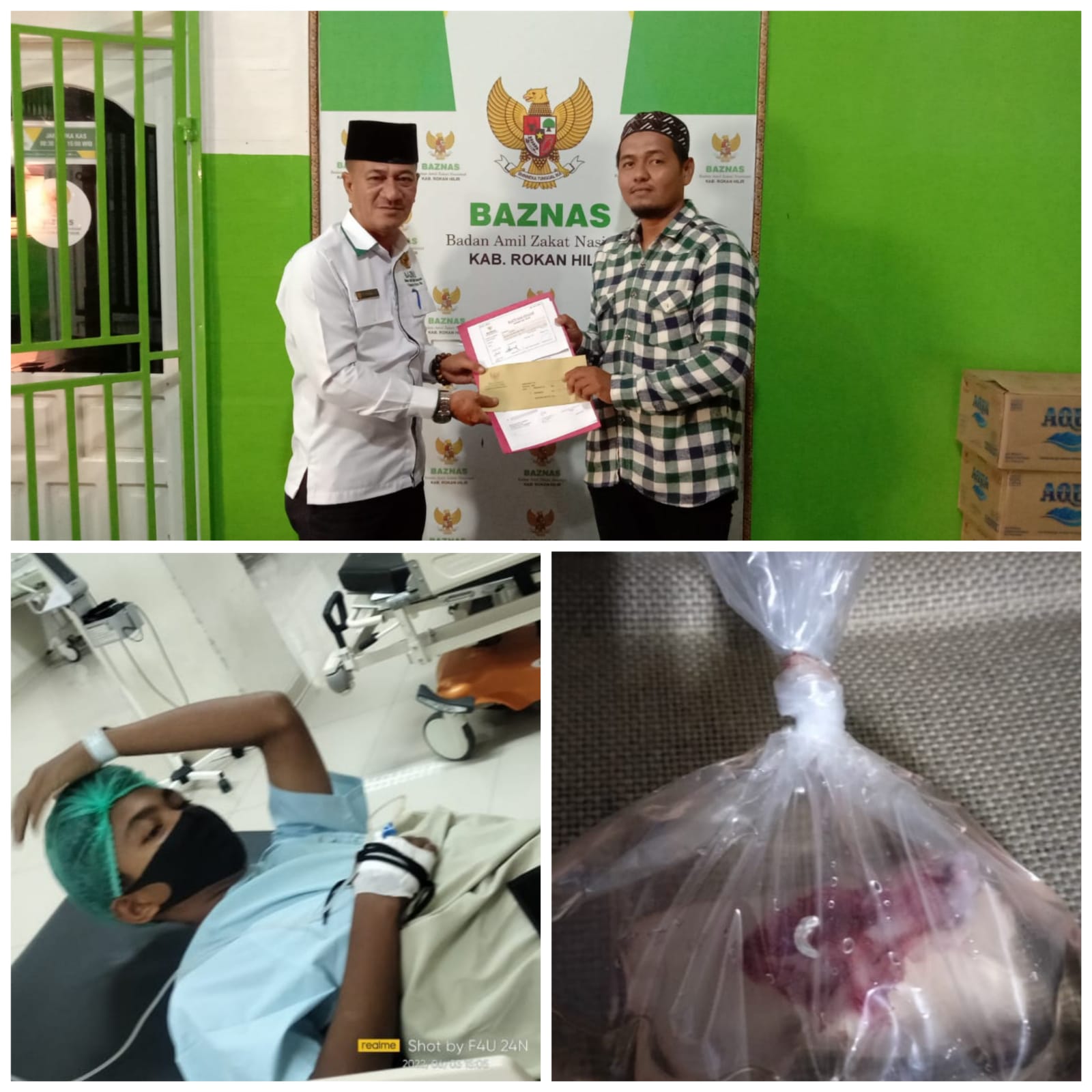 Pemerintah Kabupaten Rohil Melalui Baznas Serahkan Bantuan Kepada Keluarga Fahkrurrozi Yang Mengidap Penyakit Tumor.